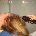 Лечение выпадения волос дорсонвалем