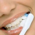Профессиональная чистка (гигиена) зубов