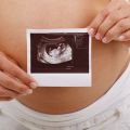 Ведение беременности в центре акушерства и гинекологии «Биопрестиж-медицина»