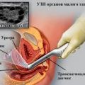 УЗИ органов малого таза (вагинальным датчиком)