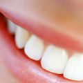 Протезирование металлокерамикой на живых зубах 1. ед
