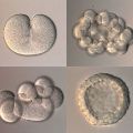 Перенос размороженных эмбрионов