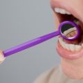 Подвижность зубов: опасно ли это?