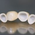 Ортопедическая стоматология. Безметалловая керамика