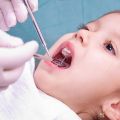 Детская стоматология. Пломбирование молочного зуба