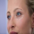 Блефаропластика – минус 30%