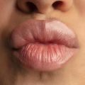 Сочные губы: выгодное спецпредложение от нашего хирурга