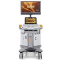 Siemens Acuson S3000